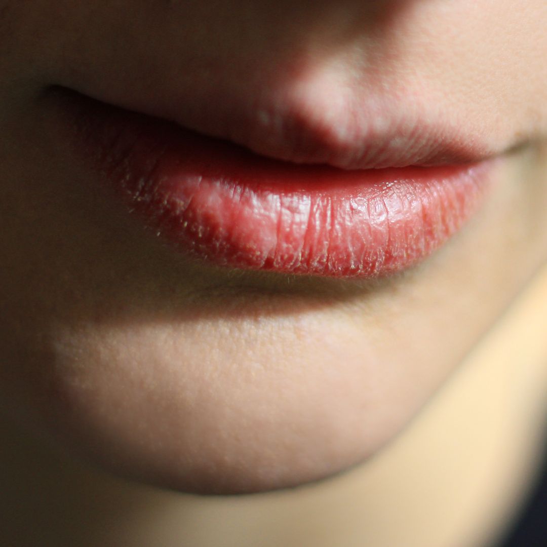 Como afecta a tu salud bucodental la boca seca